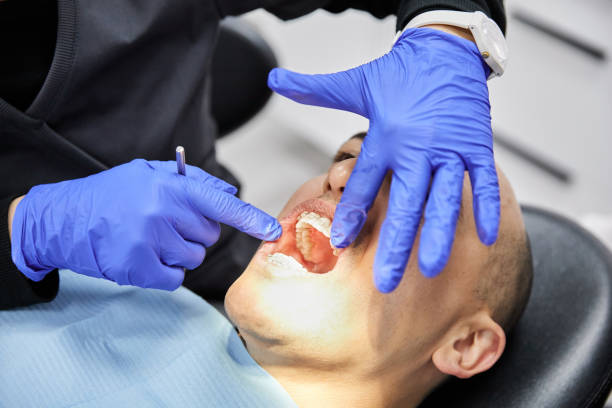 Best Knocked-Out Tooth (Avulsed Tooth) Treatment in Shell Lake, WI